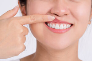 san diego laser gum treatment