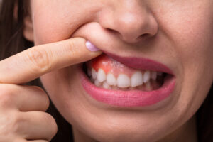 encinitas gum disease