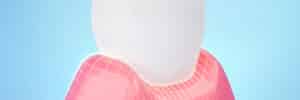 encinitas dental lasers
