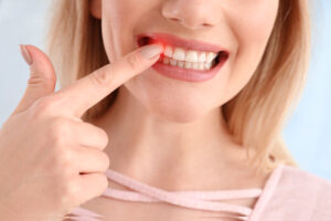 encinitas gum disease dangers