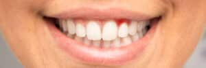 encinitas gum disease