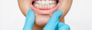encinitas jawbone grafting