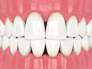 encinitas gum grafts