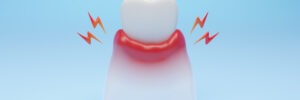 encinitas gum disease