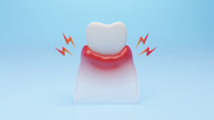 encinitas gum disease