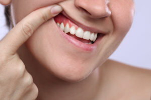 encinitas gum disease