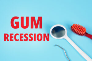encinitas gum recession