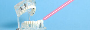 encinitas laser treatment