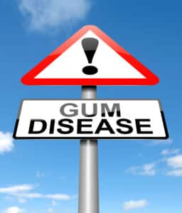 encinitas gum disease