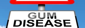 encinitas gum disease