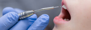 encinitas dental lasers