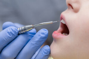 encinitas dental lasers