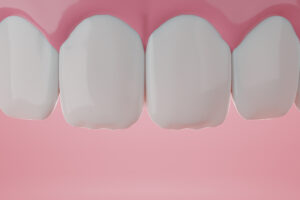 encinitas perio lasers