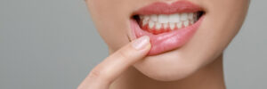 encinitas laser dentistry