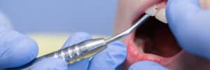 encinitas laser repair