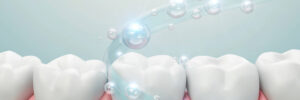 encinitas gum grafts