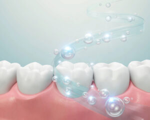 encinitas gum grafts