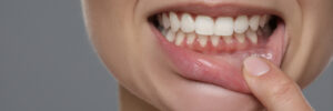 encinitas gum disease