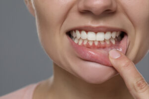 encinitas gum disease