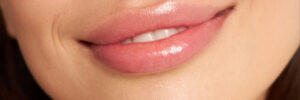 encinitas laser treatment