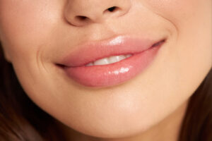 encinitas laser treatment