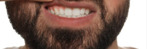 encinitas gum disease