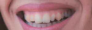 encinitas laser grafting