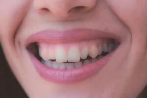 encinitas laser grafting